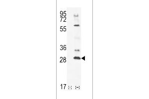 Western blot analysis of TSSK4 using rabbit polyclonal TSSK4 Antibody using 293 cell lysates (2 ug/lane) either nontransfected (Lane 1) or transiently transfected (Lane 2) with the TSSK4 gene. (TSSK4 抗体  (C-Term))
