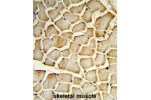 Formalin-fixed and paraffin-embedded human skeletal muscle reacted with PIK4CB Antibody (Center), which was peroxidase-conjugated to the secondary antibody, followed by DAB staining. (PI4KB 抗体  (Middle Region))