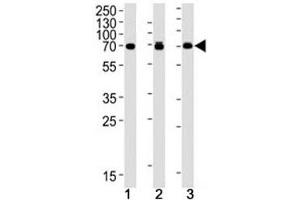 S6K2 antibody western blot analysis in human (1) Jurkat, (2) MCF-7 and (3) mouse NIH3T3 cell lysate. (RPS6KB2 抗体)