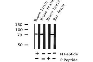 Western Blotting (WB) image for anti-Forkhead Box O1 (FOXO1) (pSer256) antibody (ABIN6255137)