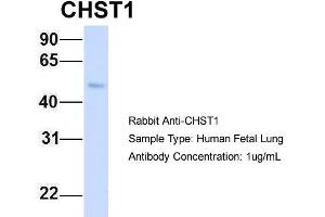 Host: Rabbit Target Name: CHST1 Sample Type: Human Fetal Lung Antibody Dilution: 1. (CHST1 抗体  (Middle Region))