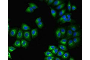 Immunofluorescent analysis of A549 cells using ABIN7164501 at dilution of 1:100 and Alexa Fluor 488-congugated AffiniPure Goat Anti-Rabbit IgG(H+L)