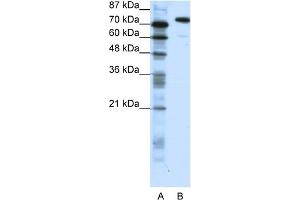 WB Suggested Anti-SATB1 Antibody Titration:  1. (SATB1 抗体  (C-Term))