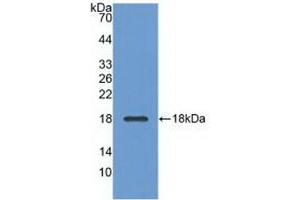 Detection of Recombinant ADP, Bovine using Polyclonal Antibody to Adiponectin (ADPN) (ADIPOQ 抗体  (AA 103-240))