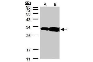 WB Image Sample(30 μg of whole cell lysate) A:Hep G2, B:MOLT4, 12% SDS PAGE antibody diluted at 1:500 (HOXC11 抗体)