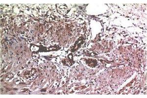 Immunohistochemistry (Paraffin-embedded Sections) (IHC (p)) image for anti-Matrix Metalloproteinase 2 (MMP2) antibody (ABIN7250629)