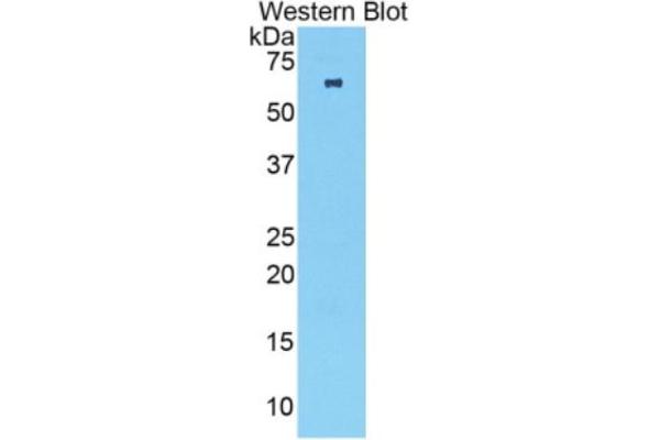 TNNC2 ELISA 试剂盒