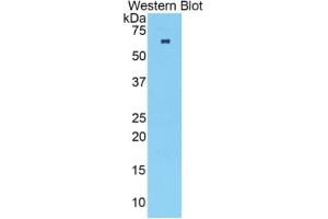 WB of Protein Standard: different control antibodies  against Highly purified E. (TNNC2 ELISA 试剂盒)