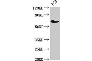 Western Blot Positive WB detected in: PC-3 whole cell lysate All lanes: ICK antibody at 3 μg/mL Secondary Goat polyclonal to rabbit IgG at 1/50000 dilution Predicted band size: 72, 35 kDa Observed band size: 72 kDa (ICK 抗体  (AA 150-275))