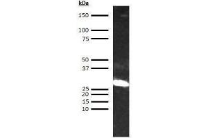 Western Blotting (WB) image for anti-alpha 1 Microglobulin/bikunin precursor (AMBP) antibody (Biotin) (ABIN613255) (AMBP 抗体  (Biotin))