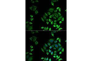 Immunofluorescence analysis of U2OS cells using PLA2G2D antibody (ABIN5974308). (PLA2G2D 抗体)