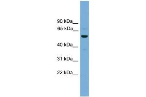 WB Suggested Anti-ASZ1 Antibody Titration: 1. (ASZ1 抗体  (Middle Region))