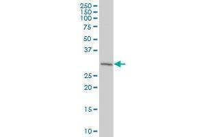 PURA polyclonal antibody (A01), Lot # OHS1060112QC01. (PURA 抗体  (AA 183-292))