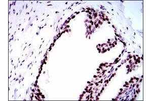 Immunohistochemistry (IHC) image for anti-Replication Protein A1, 70kDa (RPA1) antibody (ABIN1846411) (RPA1 抗体)