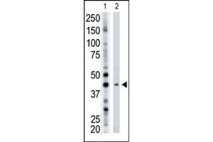 The anti-ART3 Pab (ABIN389010 and ABIN2839235) is used in Western blot to detect ART3 in mouse brain tissue lysate. (ART3 抗体  (N-Term))