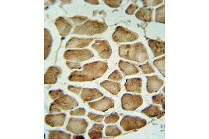CA3 Antibody (Center) (ABIN652368 and ABIN2841753) IHC analysis in formalin fixed and paraffin embedded skeletal muscle followed by peroxidase conjugation of the secondary antibody and DAB staining. (CA3 抗体  (AA 146-177))