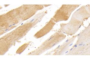 Detection of TTN in Human Skeletal muscle Tissue using Polyclonal Antibody to Titin (TTN) (Titin 抗体  (AA 33779-34025))