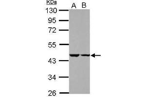 WB Image Sample (30 ug of whole cell lysate) A: HeLa B: HepG2 10% SDS PAGE antibody diluted at 1:1000 (C18ORF25 抗体)