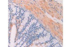 IHC-P analysis of Mouse Large Intestine Tissue, with DAB staining. (CA7 抗体  (AA 58-217))