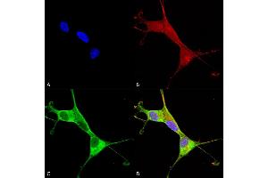 Immunocytochemistry/Immunofluorescence analysis using Mouse Anti-Copper Transporting ATPase 1 Monoclonal Antibody, Clone S60-4 (ABIN2485193).