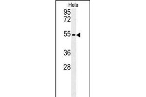 KLF17 Antibody (C-term) (ABIN651698 and ABIN2840365) western blot analysis in Hela cell line lysates (35 μg/lane). (KLF17 抗体  (AA 243-271))