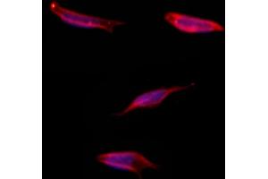 ABIN6265040 and ABIN6273317 staining Hela by IF/ICC. (SGCG 抗体  (C-Term))