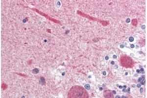 Human Brain, Cerebellum (formalin-fixed, paraffin-embedded) stained with Calmodulin antibody ABIN364349 at 10 ug/ml followed by biotinylated anti-mouse IgG secondary antibody ABIN481714, alkaline phosphatase-streptavidin and chromogen. (Calmodulin 1 抗体  (AA 1-149))