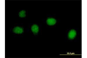 Immunofluorescence of purified MaxPab antibody to C1orf73 on HeLa cell. (INTS7 抗体  (AA 1-962))