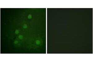 Immunofluorescence analysis of COS7 cells, using RAD52 (Ab-104) Antibody. (RAD52 抗体  (AA 70-119))