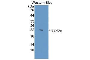 Detection of Recombinant C1INH, Rat using Polyclonal Antibody to Complement 1 Inhibitor (C1INH) (SERPING1 抗体  (AA 148-270))