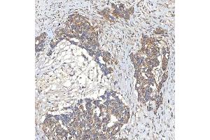 IHC analysis of SLC20A1 using anti-SLC20A1 antibody (ABIN7602463).