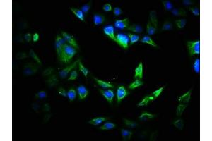 Immunofluorescence staining of Hela cells with ABIN7170532 at 1:200, counter-stained with DAPI. (VIPAR 抗体  (AA 1-493))