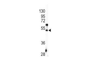 Western blot analysis of anti-AGT Antibody (C-term) (ABIN392328 and ABIN2841975) in HepG2 cell line lysates (35 μg/lane). (AGT 抗体  (C-Term))