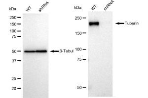 Western blotting analysis using Tuberin antibody (ABIN7800658). (Recombinant Tuberin 抗体)