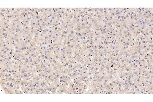 Detection of COMT in Human Liver Tissue using Polyclonal Antibody to Catechol-O-Methyltransferase (COMT) (COMT 抗体  (AA 52-271))