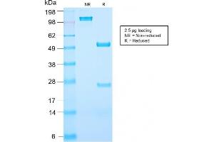 SDS-PAGE Analysis Purified PSA Rabbit Recombinant Monoclonal Antibody (KLK3/2871R). (Recombinant Prostate Specific Antigen 抗体)