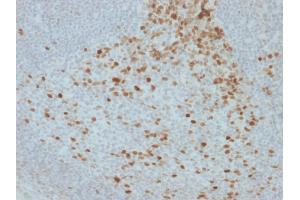 Formalin-fixed, paraffin-embedded human Lymph Node stained with Proliferation Marker Mouse Monoclonal Antibody (JC1). (Proliferation Marker 抗体)