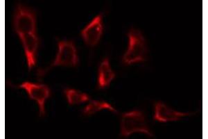 ABIN6274923 staining COLO205 by IF/ICC. (BRP44L 抗体  (Internal Region))