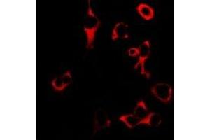 Immunofluorescent analysis of Granzyme B staining in U2OS cells. (GZMB 抗体)
