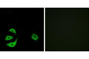 Immunofluorescence analysis of A549 cells, using ACOT8 antibody. (ACOT8 抗体)