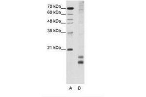 Image no. 1 for anti-Transcription Factor MafF (MAFF) (AA 33-82) antibody (ABIN203018) (MafF 抗体  (AA 33-82))