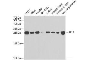 Western blot analysis of extracts of various cell lines using RPL9 Polyclonal Antibody at dilution of 1:1000. (RPL9 抗体)