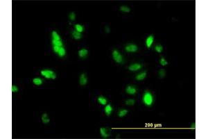 Immunofluorescence of monoclonal antibody to UBE2C on HeLa cell. (UBE2C 抗体  (AA 70-179))