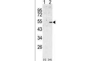 Western blot analysis of CCNA2 (arrow) using rabbit polyclonal CCNA2 Antibody (C-term) (ABIN391455 and ABIN2841432). (Cyclin A 抗体  (C-Term))