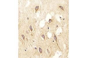 Immunohistochemistry (Paraffin-embedded Sections) (IHC (p)) image for anti-Nitric Oxide Synthase 2, Inducible (NOS2) (AA 830-860) antibody (ABIN655717)