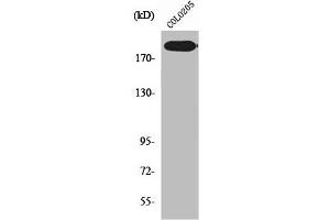 Western Blot analysis of COLO205 cells using XPG Polyclonal Antibody (ERCC5 抗体  (N-Term))