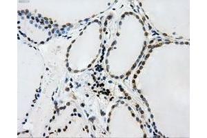 Immunohistochemical staining of paraffin-embedded Kidney tissue using anti-L1CAMmouse monoclonal antibody. (L1CAM 抗体)