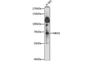 Western blot analysis of extracts of K-562 cells, using MKKS antibody (ABIN6293382) at 1:1000 dilution. (MKKS 抗体)