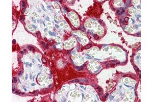 IHC Information: Paraffin embedded placenta tissue, tested with an antibody dilution of 5 ug/ml. (Transglutaminase 2 抗体  (Middle Region))