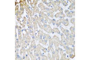 Immunohistochemistry of paraffin-embedded human liver injury using COX5B antibody at dilution of 1:100 (x40 lens). (COX5B 抗体)